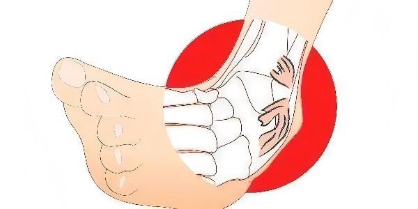踝關(guān)節(jié)扭傷后的最佳應(yīng)對(duì)指南：簡單四步，助力快速康復(fù)！